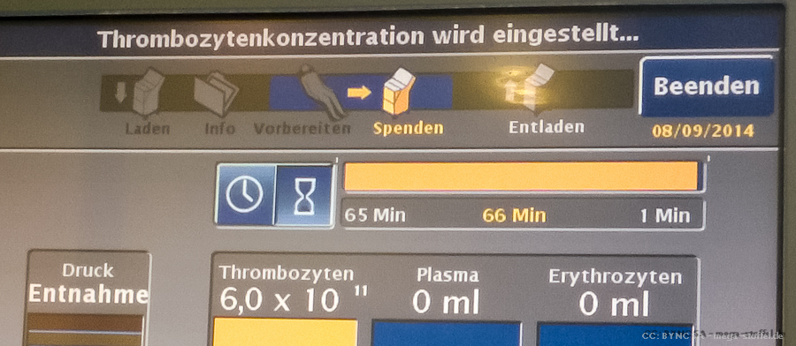 Thrombozyten-Süenden-Bildschirm